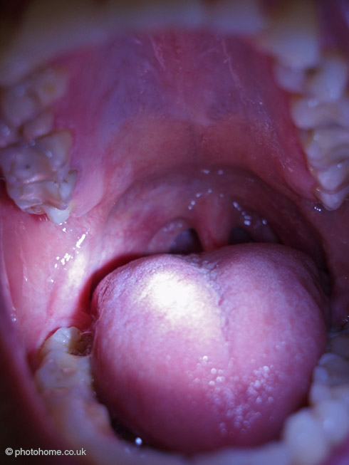 inside human mouth